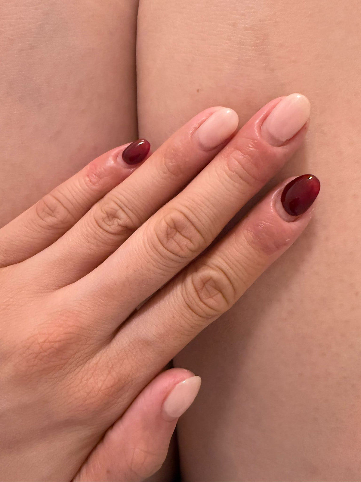 Reactive Skin, 8-Week Programme — after